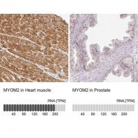 Anti-MYOM2 antibody produced in rabbit
