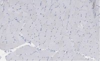 Anti-Myosin Heavy Chain 7 Antibody, clone 1B19, ZooMAb® Rabbit Monoclonal