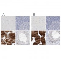 Anti-MYOT antibody produced in rabbit