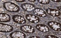 Anti-Na+-K+ ATPase 1 Antibody, clone 1E13 ZooMAb� Rabbit Monoclonal 