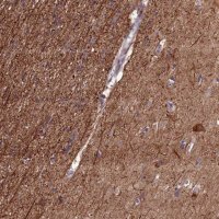 Anti-NAA60 antibody produced in rabbit HPA040916-100UL