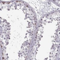Anti-NANOS3 antibody produced in rabbit