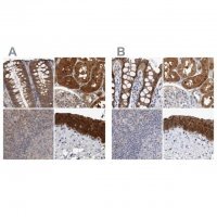 Anti-NAPRT antibody produced in rabbit 