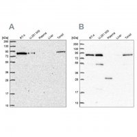 Anti-NCBP1 antibody produced in rabbit HPA049031-100UL