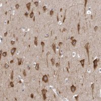 Anti-NCEH1 antibody produced in rabbit 