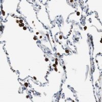 Anti-NCF2 antibody produced in rabbit HPA006040-100UL