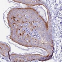 Anti-NCK2 antibody produced in rabbit HPA031004-100UL