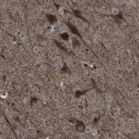 Anti-NCKAP1 antibody produced in rabbit 