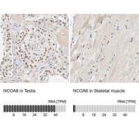 Anti-NCOA6 antibody produced in rabbit 