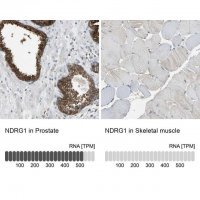 Anti-NDRG1 antibody produced in rabbit