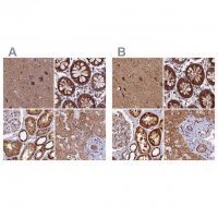 Anti-NDUFA8 antibody produced in rabbit HPA041510-100UL