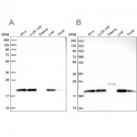 Anti-NDUFA8 antibody produced in rabbit HPA041510-100UL