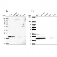 Anti-NDUFAF2 antibody produced in rabbit