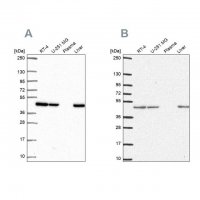 Anti-NDUFS2 antibody produced in rabbit 