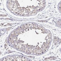 Anti-NEFH antibody produced in rabbit 