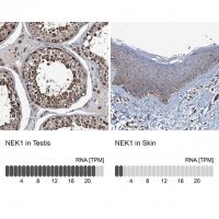 Anti-NEK1 antibody produced in rabbit