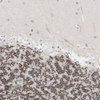 Anti-NEUROD1 antibody produced in rabbit 