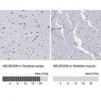 Anti-NEUROD6 