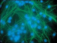 Anti-Neurofilament 200 antibody produced in rabbit 