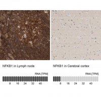 Anti-NFKB1 antibody produced in rabbit 