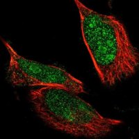 Anti-NLK antibody produced in rabbit