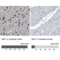 Anti-NMT1 antibody produced in rabbit 