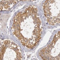 Anti-NMT2 antibody produced in rabbit 