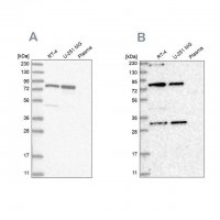 Anti-NOA1 antibody produced in rabbit 
