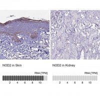 Anti-NOD2 antibody produced in rabbit 