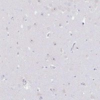 Anti-NOP14 antibody produced in rabbit