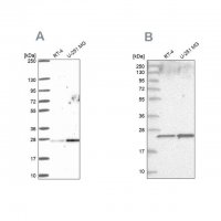 Anti-NOP16 antibody produced in rabbit