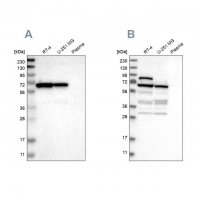 Anti-NOP58 antibody produced in rabbit 