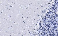 Anti-NOS1 Antibody, clone 1F14 ZooMAb� Rabbit Monoclonal 