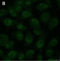 Anti-Notch1 Antibody, clone 1A32 ZooMAb� Rabbit Monoclonal 