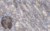 Anti-NOTCH2 Antibody, clone 1B14-5 ZooMAb� Rabbit Monoclonal 