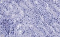Anti-NOTCH2 Antibody, clone 1B14-5 ZooMAb� Rabbit Monoclonal 