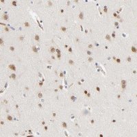 Anti-NOVA1 antibody produced in rabbit 