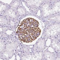 Anti-NPHS2 antibody produced in rabbit