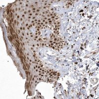 Anti-NPM3 antibody produced in rabbit