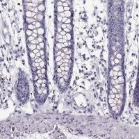 ANTI-NPTXR antibody produced in rabbit 