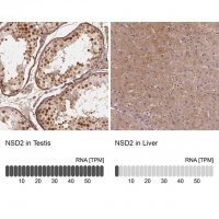 Anti-NSD2 antibody produced in rabbit 