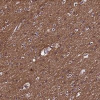 Anti-NSMF antibody produced in rabbit