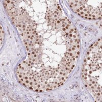 Anti-NSUN2 antibody produced in rabbit