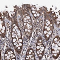 Anti-NT5C3A antibody produced in rabbit 