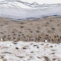 Anti-NUDCD3 antibody produced in rabbit 