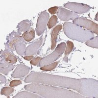 Anti-NUDT8 antibody produced in rabbit 