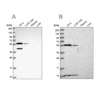 Anti-NUP50 antibody produced in rabbit