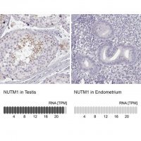 Anti-NUTM1 antibody produced in rabbit 