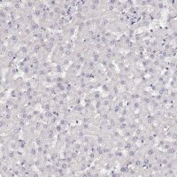 Anti-NUTM1 antibody produced in rabbit 