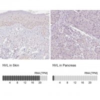 Anti-NVL antibody produced in rabbit HPA028224-100UL